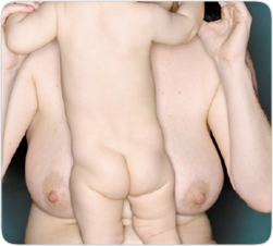 breast04